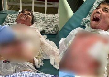 Kimyasal silahla yaralandığından şüphelenilen çocuğun tedavisi Erbil’de yapılacak
