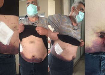 Adana’da açık kanaması olan hayırsever, tutuklanarak cezaevine gönderildi