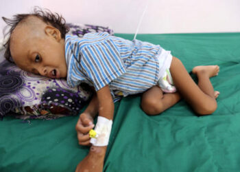 UNICEF Başkanı: Yemen’de 12 milyondan fazla çocuk insani yardıma muhtaç