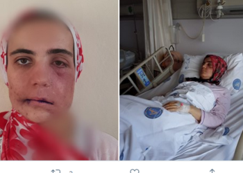 Kanser hastası Ayşe Özdoğan’ın feryadı: Çok çaresizim, sesime ses olun!