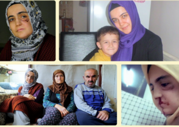 Ayşe Özdoğan’ın annesi: Dişleri yok kızımın, şırıngayla mama veriyorum