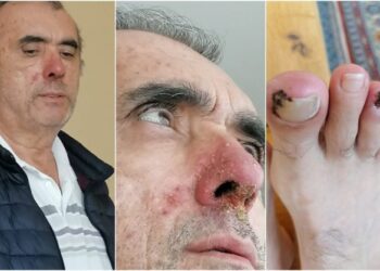 Adalet Bakanlığı nihayet duydu: Zeki Özkan’a ilaçları veriliyor, ceza tehiri işlemleri re’sen başlatıldı