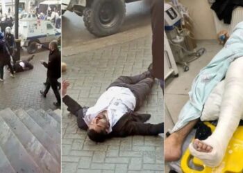 Polisin darp ettiği HDP’li Habib Eksik’in ayağı kırıldı