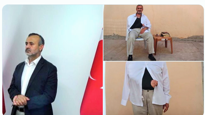 Erdoğan rejiminin fotoğrafı : MİT’in kaçırıp işkence ettiği Orhan İnandı, aylar geçmesine rağmen hala kolunu kullanamıyor