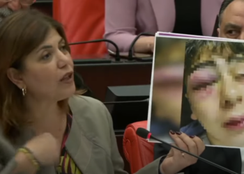 HDP Mvekili konuyu Meclis’e taşıdı: Diyarbakır’da çocuğa işkence yapan 5 polise uzaklaştırma