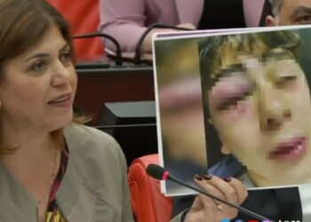 HDP Mvekili konuyu Meclis’e taşıdı: Diyarbakır’da çocuğa işkence yapan 5 polise uzaklaştırma