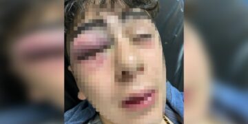 Diyarbakır Lice’de 14 yaşındaki çocuğa işkence eden 3 polise gözaltı