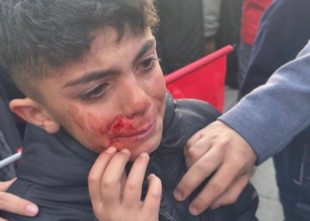Erdoğan ve Cumhur ittifakı’nın eşkıyaları, Erzurum’daki saldırıda çocukları da yaraladılar