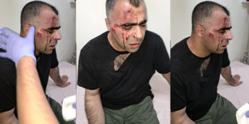 Gazeteci Sinan Aygül’e saldıran iki koruma da gözaltında