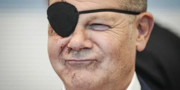 Alman Başbakan Olaf Scholz, yaralı olduğu fotoğrafı paylaştı