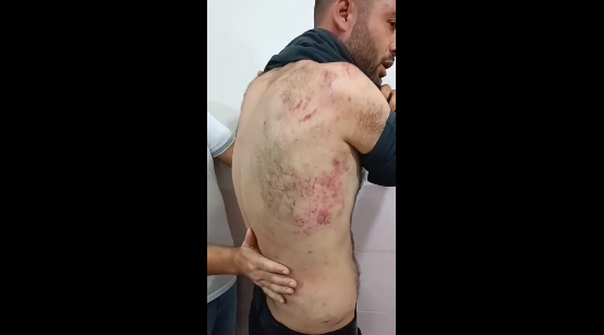 Muş’ta evine yapılan baskınla gözaltına alınan Muhammed Erol, İl Jandarma Komutanlığı’nda işkence gördü