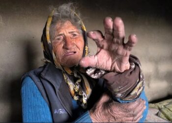 Cumhur ittifakı ortağı Bahçeli’nin memleketinde dram: 71 yaşındaki  kadının yaşam mücadelesi
