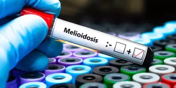 Queensland’de melioidoz hastalığı nedeniyle  31 kisi hayatını kaybetti