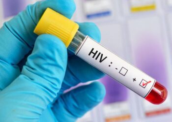 Avustralya bilim insanlarından, HIV tedavisinde tarihi adım: Virüs hücre içinde görünür hâle getirildi