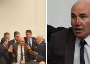 AKP’lilerin saldırısında burnu kırılan Mahmut Tanal hastaneye kaldırıldı